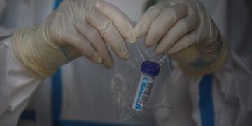 Beijing (China), 14/07/2020\u002E- A medical worker wearing a full protective outfit holds a sample after tested people for COVID-19 at Beijing Puren Hospital in Beijing, China, 14 July 2020 (issued 16 July 2020)\u002E EFE/EPA/WU HONG