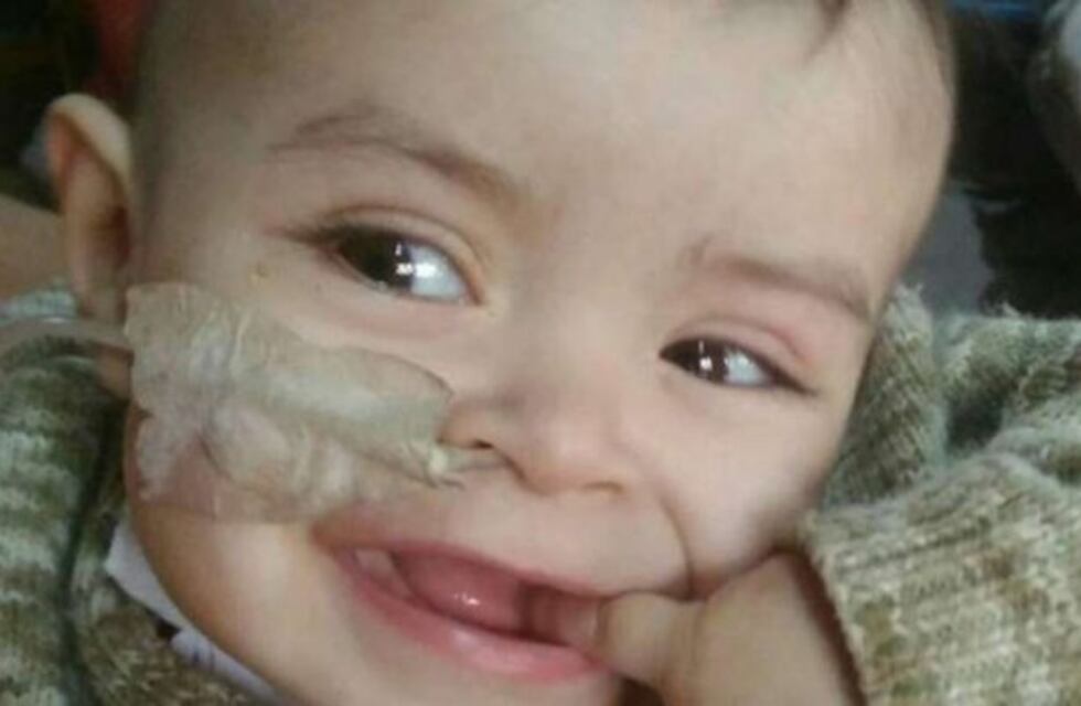 Eithan padece hidrocefalia y su familia pide ayuda para tratar su enfermedad