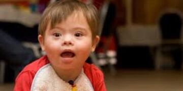 Día Mundial del Síndrome de Down