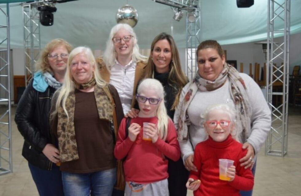 Despeñaderos: se realizó una charla sobre el albinismo