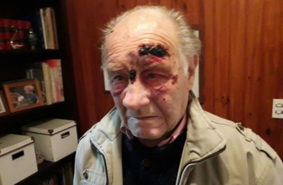 Violento asalto a un jubilado en General Cabrera