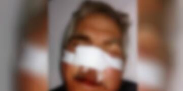 Golpiza en Bell Ville a un expolicía para robarle\u002E