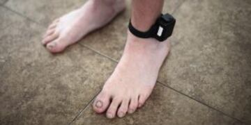 A probationer wears an ankle tracking device in Santa Ana, California July 22, 2011. The Supreme Court has ordered California to release more than 30,000 inmates over the next two years or take other steps to ease overcrowding in its prisons to prevent