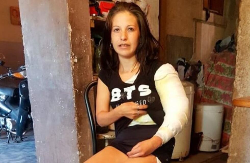 Su pareja la roció con alcohol y le prendió fuego: "Pensé que me moría, me tiré abajo de un pico"
