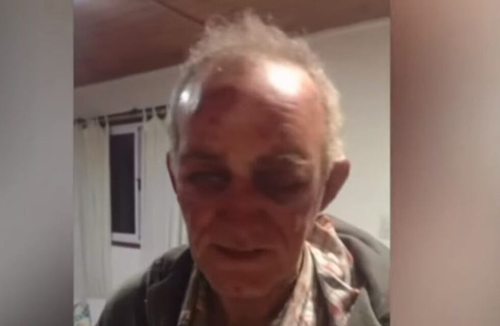 Impresionante golpiza y tortura a un hombre en Saldán para robarle