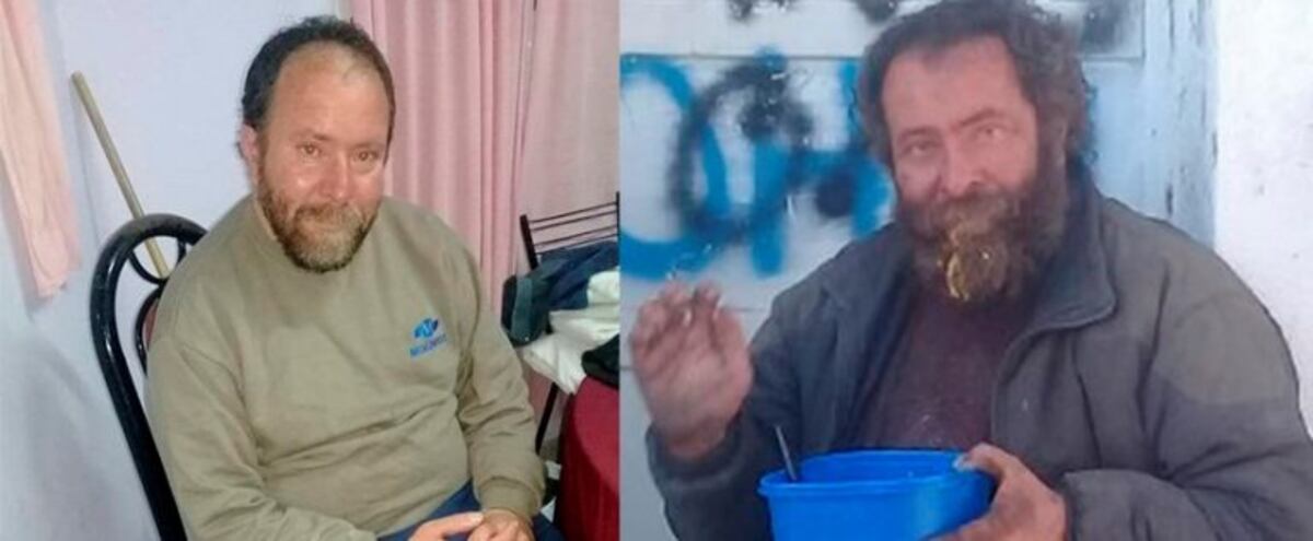 sergio vagabundo antes y despues