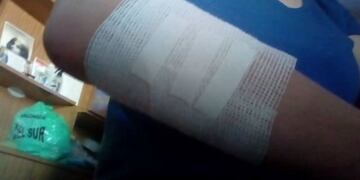 Una mujer fue violentamente atacada por un motochorro