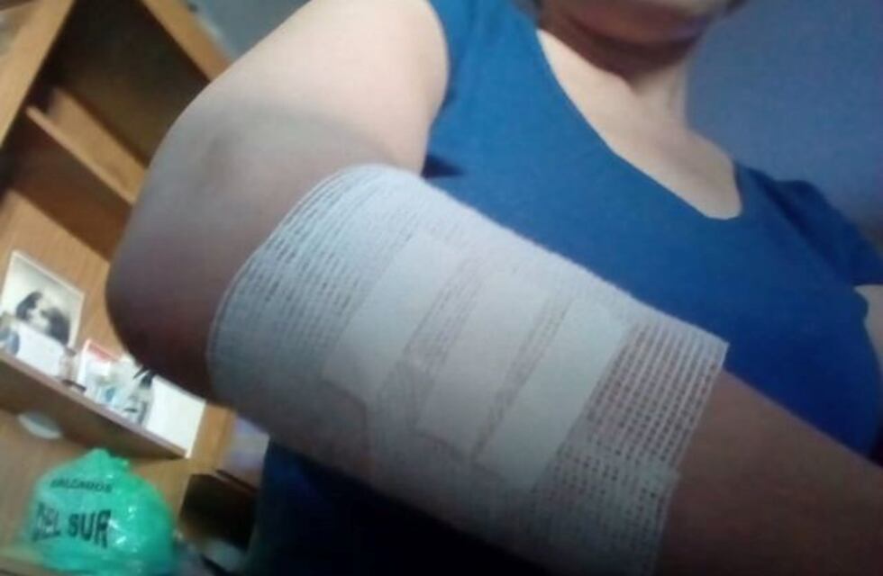 Una mujer fue violentamente atacada por un motochorro cuando bajaba de un colectivo