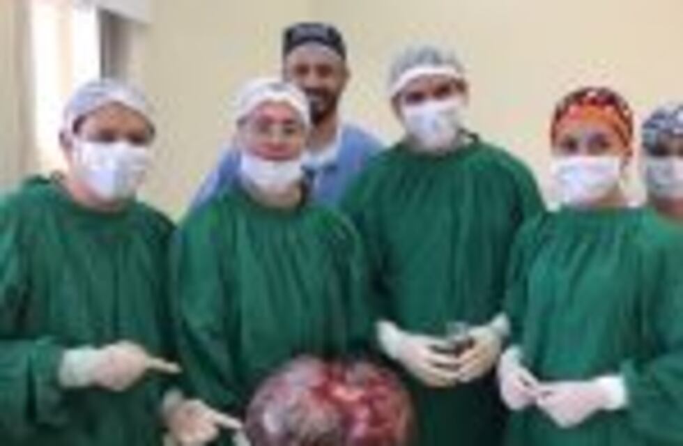 Le extirparon un tumor de 15 kilos a una mujer en Catamarca