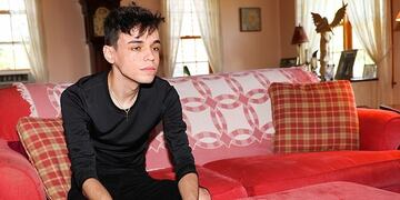 El curioso caso del adolescente que se volvió viral por tener un pulgar de 13 centímetros