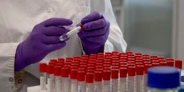 A lab technician looks puts a label on a test tube during research on coronavirus, COVID-19, at Johnson & Johnson subsidiary Janssen Pharmaceutical in Beerse, Belgium, Wednesday, June 17, 2020\u002E Janssen Pharmaceutical hopes to begin clinical trials on a potential vaccine for COVID-19 in the middle of the summer\u002E (AP Photo/Virginia Mayo)