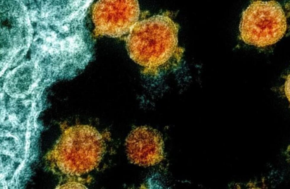 Científicos en Indonesia identificaron una cepa de coronavirus 10 veces más contagiosa que la de Wuhan