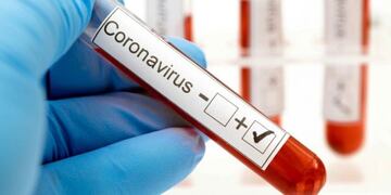 Test positivo coronavirus