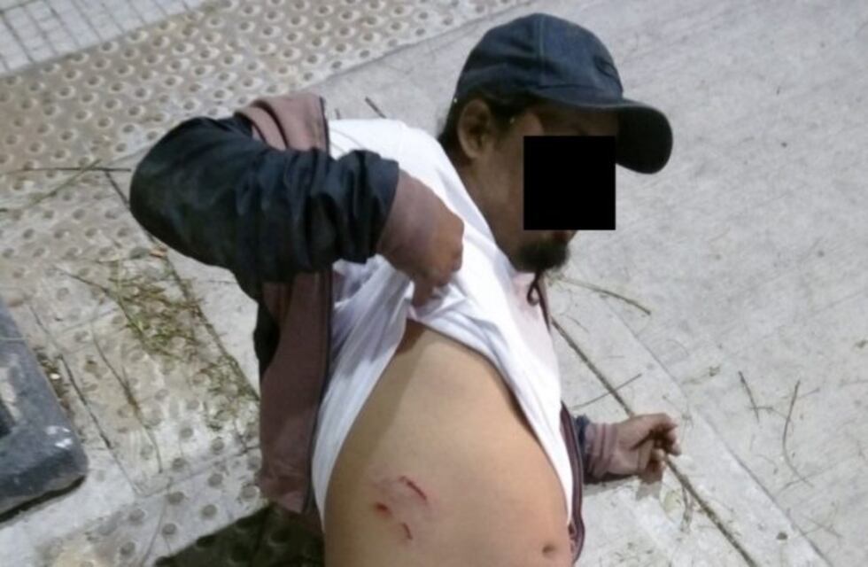Dos policías separados por no asistir al hombre apuñalado en el Obelisco