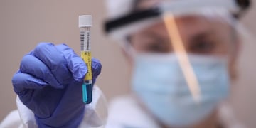 A member of the medical personnel shows a PCR test for the coronavirus disease (COVID-19) at a COVID-19 testing center at Saint-Jean Clinic in Brussels, Belgium October 14, 2020\u002E REUTERS/Yves Herman