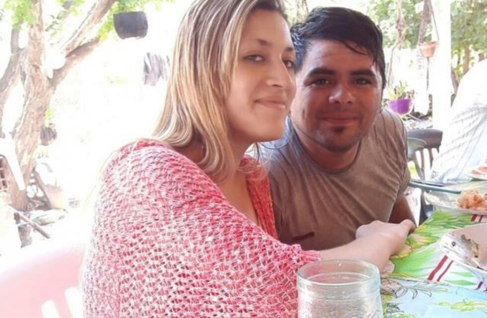 Se quemó la cara "para estar fea" y que así su novio dejara de celarla