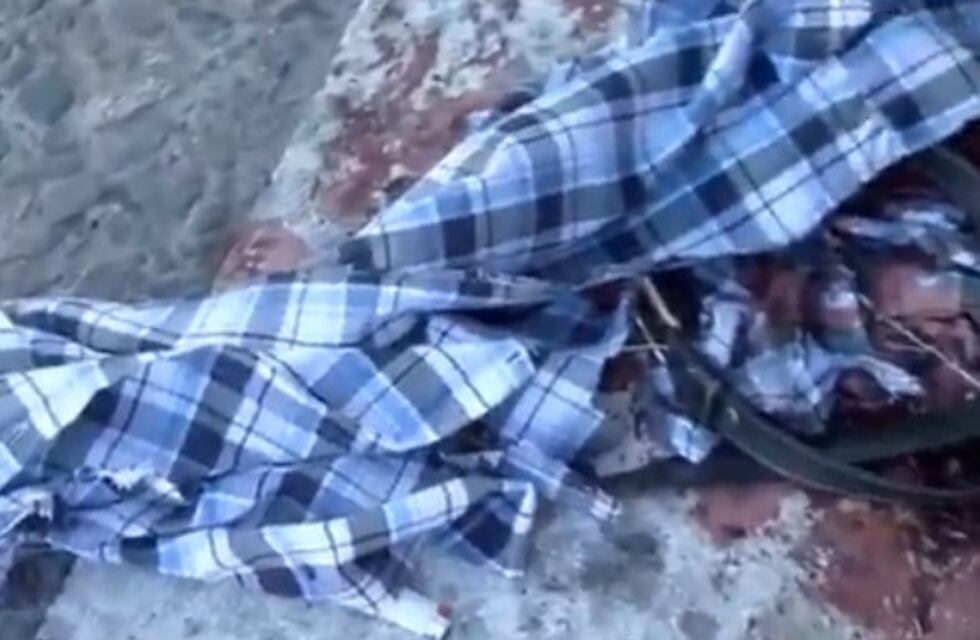 A un motociclista debieron hacerle un torniquete tras quedar debajo de un camión