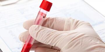 Aumentaron los casos de su00edfilis en Mednoza.