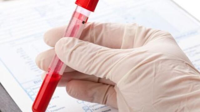 Aumentaron los casos de su00edfilis en Mednoza.