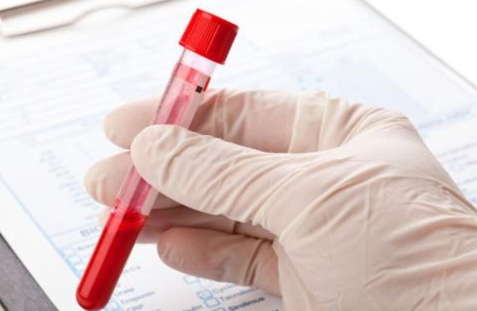 Aumentaron un 55% los casos de sífilis en Mendoza