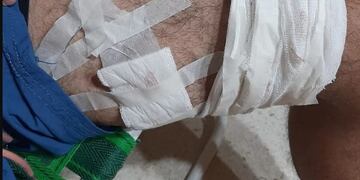 El joven recibió un balazo en su rodilla izquierda. Imagen ilustrativa.