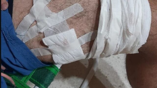 El joven recibió un balazo en su rodilla izquierda. Imagen ilustrativa.