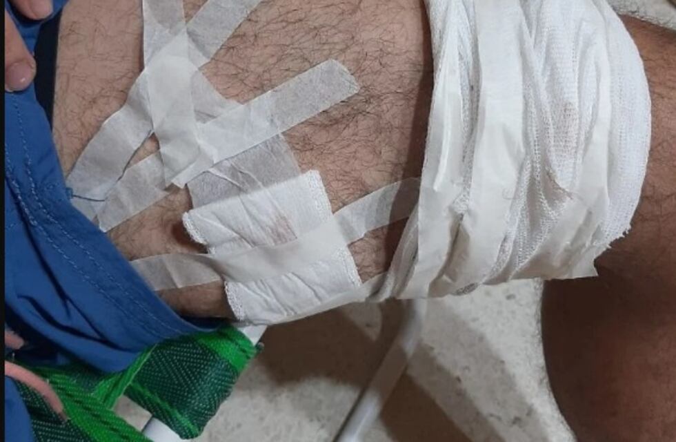 Su ex cuñado le dio un balazo en la rodilla y lo dejó hospitalizado