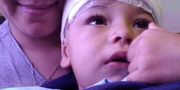 Faustino tiene 2 años y terminó con hundimiento de cráneo\u002E
