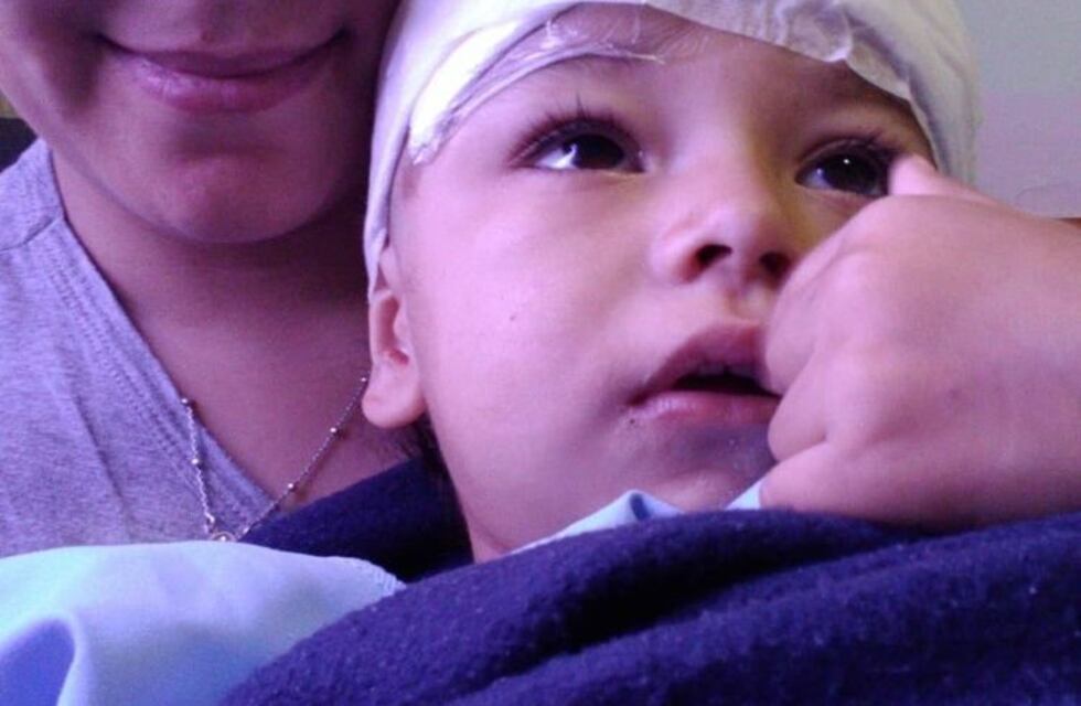 Bebé terminó con lesiones en el cráneo porque se le cayó un basurero encima