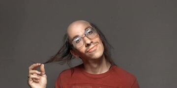 Un shampoo argentino esperanza a los calvos