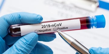 Covid-19: La Rioja suma un nuevo positivo y ya son 11 los casos activos