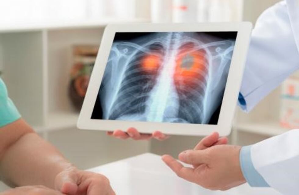 La increíble máquina de Google que puede detectar el cáncer antes que el ojo humano