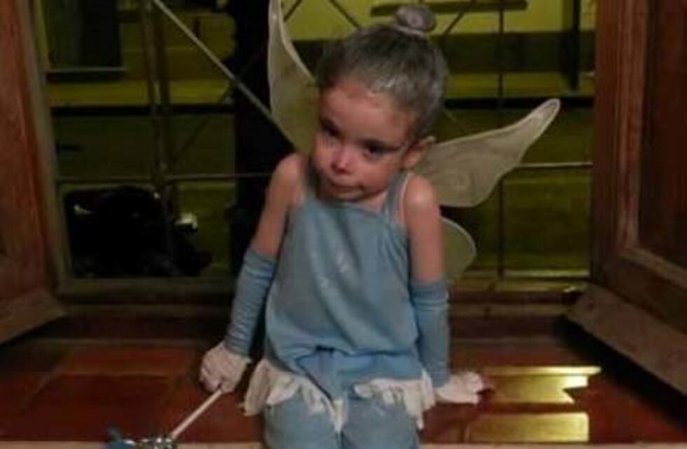 Por maltrato animal, un hombre tuvo que hacer una donación en favor de una nena con piel de cristal