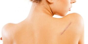 Semana de la Cicatriz en Córdoba organizada por la Universidad Nacional de Córdoba\u002E