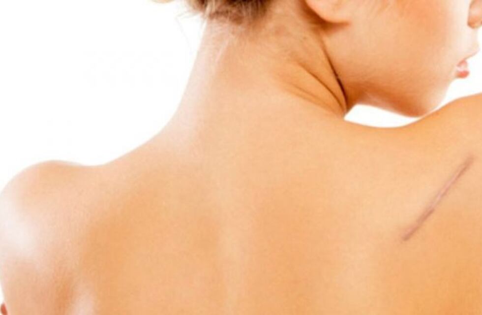 Llega una nueva edición de la Semana de la Cicatriz