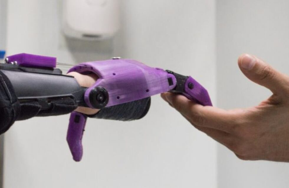 La UNCuyo fabricará prótesis 3D para pacientes del hospital Lencinas