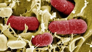 Síndrome urémico hemolítico. (web)