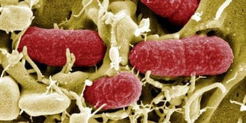 Síndrome urémico hemolítico\u002E (web)