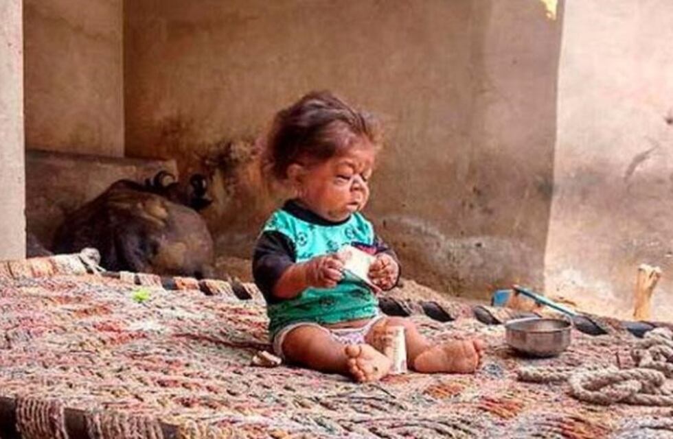 El sorprendente caso de un joven de 23 años "atrapado" en el cuerpo de un bebé