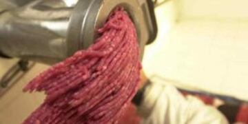 Aumentaron los casos de su00edndrome uru00e9mico hemolu00edtico