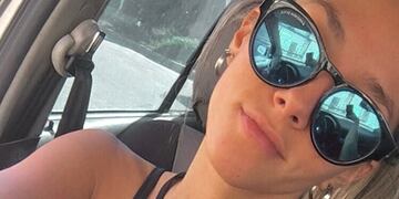 Nayla Zensich. Un joven vende su riñón por Instagram para ayudar a su hermana accidentada.