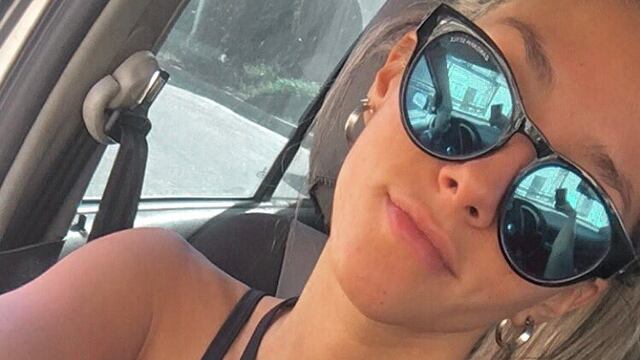 Nayla Zensich. Un joven vende su riñón por Instagram para ayudar a su hermana accidentada.