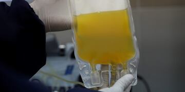 FILE - In this Friday, June 12, 2020 file photo, a doctor holds a bag of blood plasma donated by a COVID-19 survivor at at blood bank in La Paz, Bolivia\u002E  The U\u002ES\u002E Food and Drug Administration authorized the use of blood plasma for what's called “emergency use” during the coronavirus pandemic, but the World Health Organization (WHO) on Monday AUG\u002E 24, 2020, cautioned that using blood plasma from COVID-19 survivors to treat other patients is still considered an experimental therapy\u002E  (AP Photo/Juan Karita, FILE)