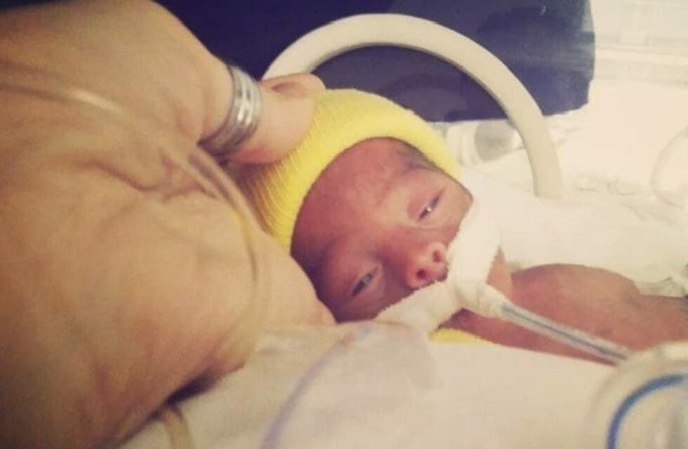 Murió Alfonsina, la bebé que movilizó las redes en San Juan