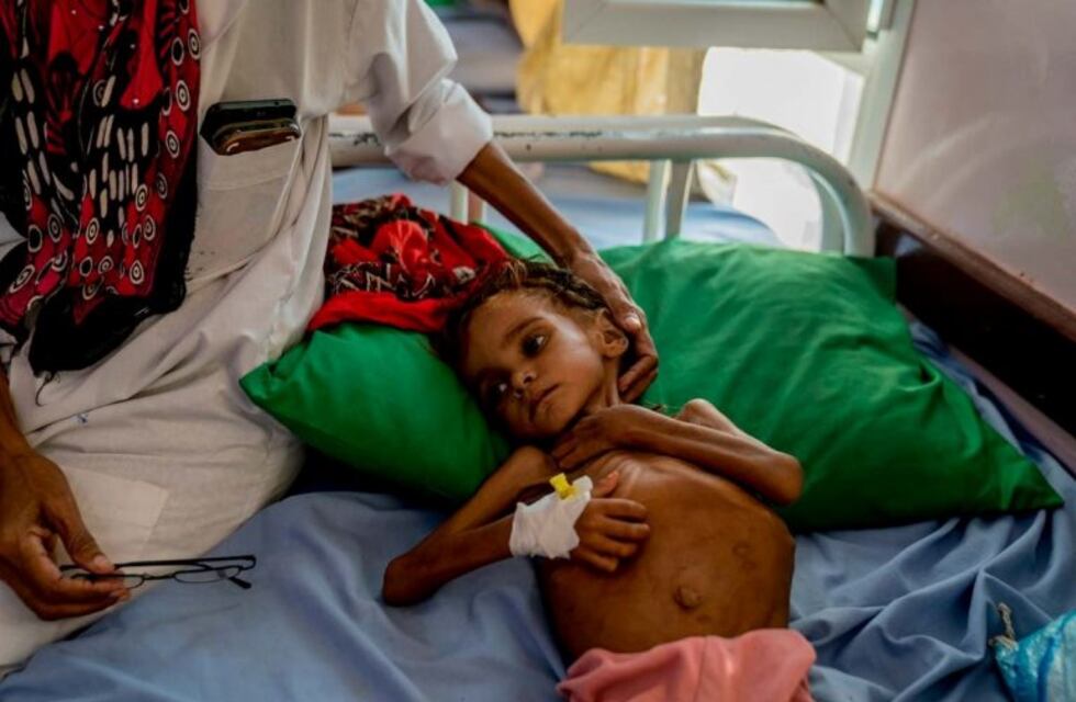 Murió Amal, la niña que se convirtió en símbolo de la guerra en Yemen