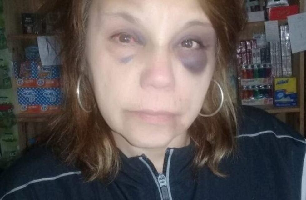 Indignante: fue brutalmente golpeada y robada por decimoctava vez