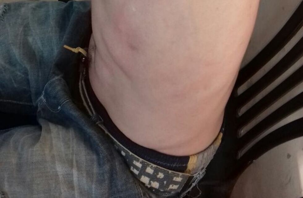 Mejora el estado de los policías heridos durante el traslado de detenidos por el caso Cantero