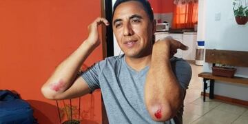 El denunciante\u002E