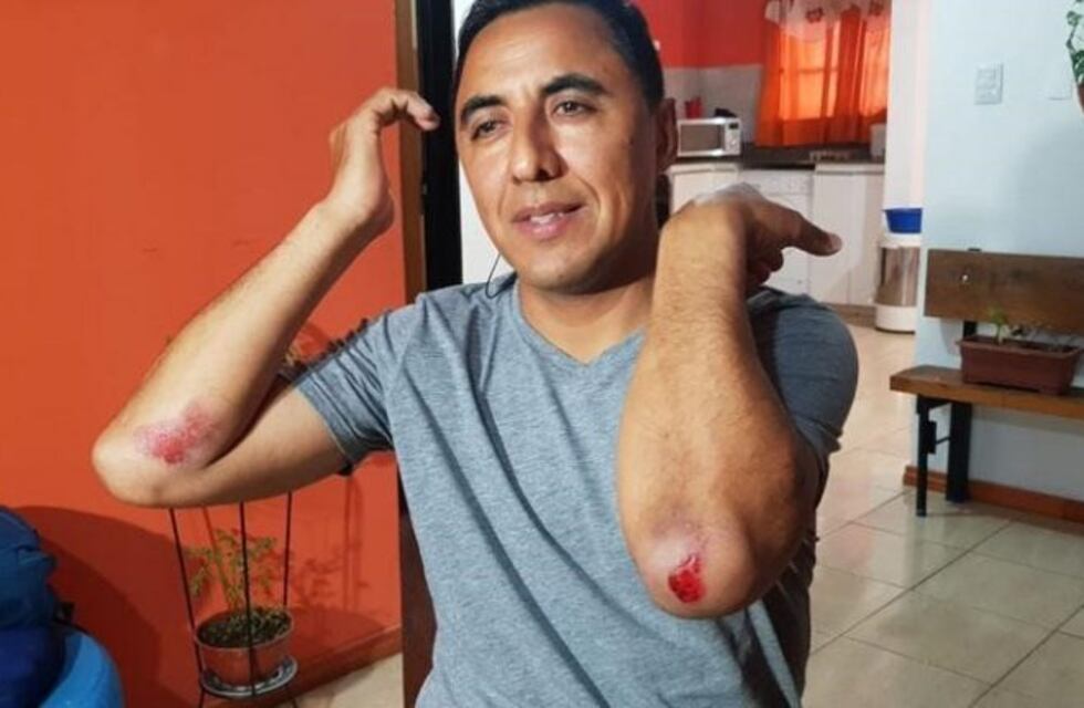 Ordenan custodia para denunciante del Surrbac