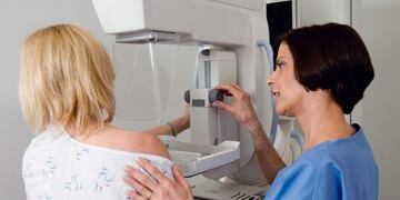 Realizarán 100 mamografías gratuitas a mujeres cordobesas